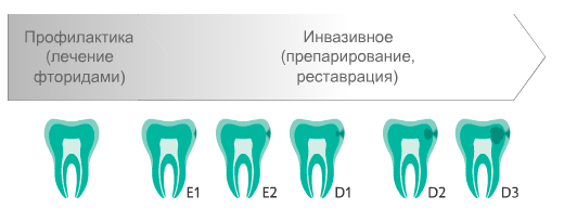 Лечения кариеса сверлением зубов до появления препарата ICON
