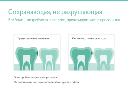Сравнение методов лечения кариеса - Icon против сверления зубов