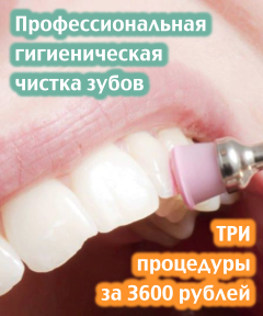 professionalnaya-chistka-zubov-tri-protsedury-za-3600-rublej-240x288-oktyabr-2016-2