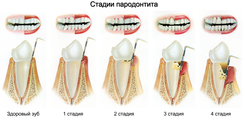 Современные методы лечения зубов